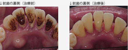 自費治療と保険治療の比較